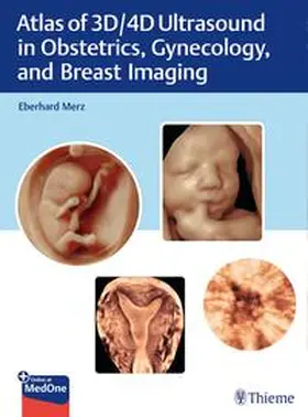 Merz | Atlas of 3D/4D Ultrasound in Obstetrics, Gynecology, and Breast Imaging | Buch | sack.de