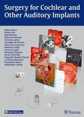 Sanna / Merkus / Free | Surgery for Cochlear and Other Auditory Implants | Medienkombination | 978-3-13-176441-6 | www.sack.de