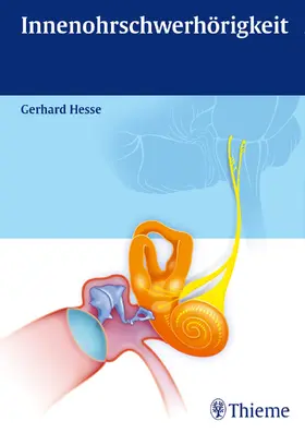 Hesse |  Innenohrschwerhörigkeit | eBook | Sack Fachmedien