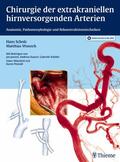 Scholz / Wunsch |  Chirurgie der extrakraniellen hirnversorgenden Arterien | eBook | Sack Fachmedien