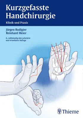 Meier / Rudigier |  Kurzgefasste Handchirurgie | eBook | Sack Fachmedien
