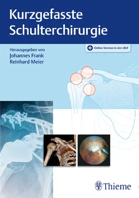 Frank / Meier | Kurzgefasste Schulterchirurgie | E-Book | www.sack.de