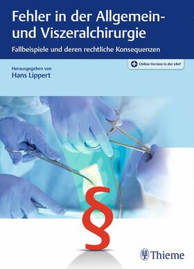 Lippert | Fehler in der Allgemein- und Viszeralchirurgie | E-Book | sack.de