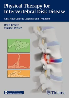 Brötz / Weller |  Physical Therapy for Intervertebral Disk Disease | Buch |  Sack Fachmedien