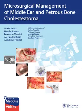Sanna / Sunose / Mancini | Sanna, M: Microsurgical Management of Middle Ear and Petrous | Medienkombination | sack.de