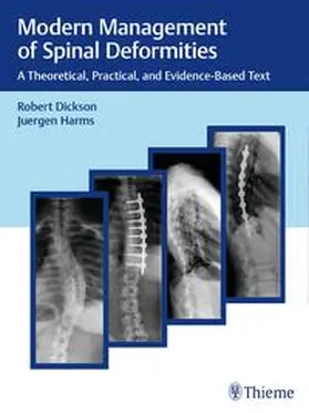 Dickson / Harms | Modern Management of Spinal Deformities | Buch | 978-3-13-201631-6 | www.sack.de