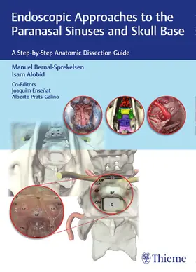 Bernal-Sprekelsen / Alobid / Ensenat |  Endoscopic Approaches to the Paranasal Sinuses and Skull Base | Buch |  Sack Fachmedien