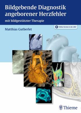Gutberlet |  Bildgebende Diagnostik angeborener Herzfehler | eBook | Sack Fachmedien