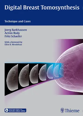 Barkhausen / Rody / Schäfer |  Digital Breast Tomosynthesis | eBook | Sack Fachmedien
