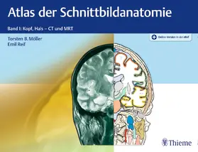 Möller / Reif | Atlas der Schnittbildanatomie | E-Book | sack.de