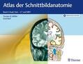 Möller / Reif |  Atlas der Schnittbildanatomie | eBook | Sack Fachmedien