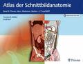 Möller / Reif |  Atlas der Schnittbildanatomie | eBook | Sack Fachmedien