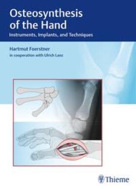 Förstner | Osteosynthesis of the Hand | E-Book | sack.de