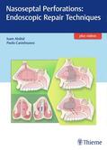 Alobid / Castelnuovo |  Nasoseptal Perforations: Endoscopic Repair Techniques | eBook | Sack Fachmedien