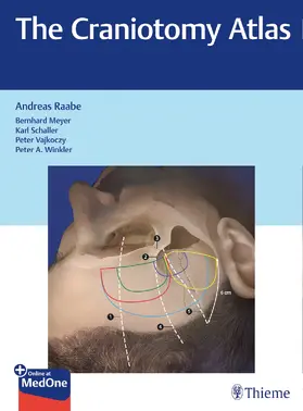 Raabe | The Craniotomy Atlas | Medienkombination | 978-3-13-205791-3 | sack.de