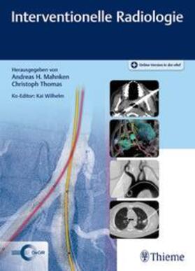 Mahnken / Thomas / Wilhelm | Interventionelle Radiologie | Medienkombination | 978-3-13-221451-4 | sack.de