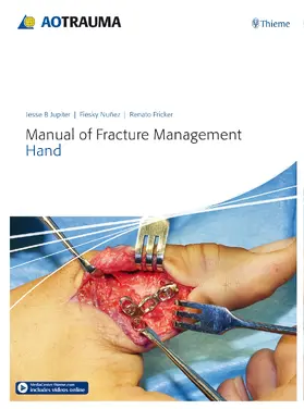 Jupiter / Nunez / Fricker |  Manual of Fracture Management - Hand | eBook | Sack Fachmedien