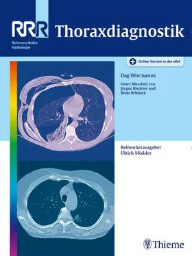 Wormanns |  Thoraxdiagnostik | eBook | Sack Fachmedien