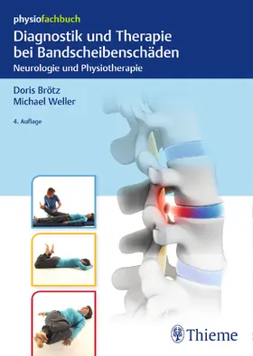 Brötz / Weller |  Diagnostik und Therapie bei Bandscheibenschäden | Buch |  Sack Fachmedien
