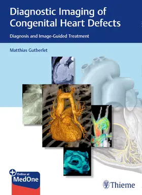 Gutberlet | Diagnostic Imaging of Congenital Heart Defects | Medienkombination | 978-3-13-240251-5 | sack.de
