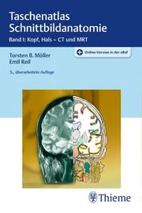 Möller / Reif | Taschenatlas Schnittbildanatomie 01 | Medienkombination | sack.de