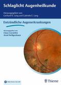 Cursiefen / Heiligenhaus |  Schlaglicht Augenheilkunde: Entzündliche Erkrankungen | eBook | Sack Fachmedien