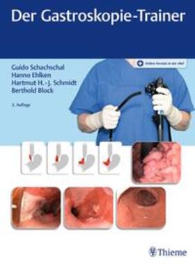 Schachschal / Ehlken / Schmidt | Der Gastroskopie-Trainer | E-Book | sack.de