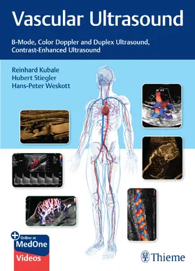 Kubale / Stiegler / Weskott | Vascular Ultrasound | Medienkombination | 978-3-13-240543-1 | sack.de