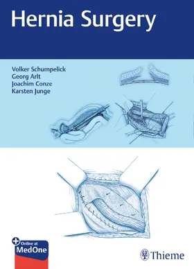 Schumpelick / Arlt / Conze | Hernia Surgery | Medienkombination | sack.de
