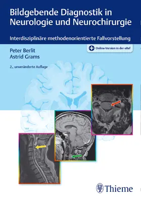 Berlit / Grams |  Bildgebende Diagnostik in Neurologie und Neurochirurgie | Buch |  Sack Fachmedien