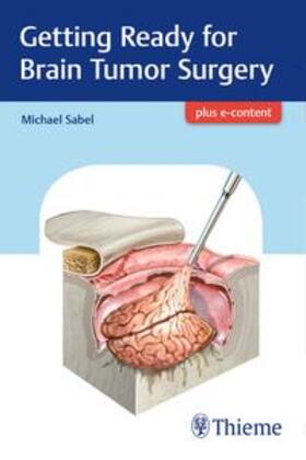 Sabel | Getting Ready for Brain Tumor Surgery | Buch | 978-3-13-240957-6 | sack.de