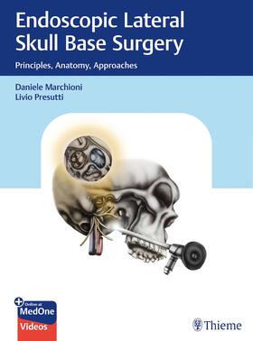 Marchioni / Presutti | Endoscopic Lateral Skull Base Surgery | Medienkombination | sack.de