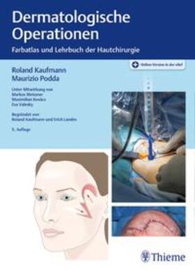 Kaufmann / Podda | Dermatologische Operationen | E-Book | sack.de