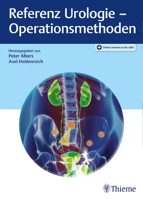 Albers / Heidenreich | Referenz Urologie - Operationsmethoden | E-Book | sack.de