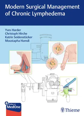 Harder / Hirche / Seidenstücker | Modern Surgical Management of Chronic Lymphedema | Medienkombination | 978-3-13-241428-0 | sack.de