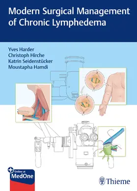 Harder / Hirche / Seidenstücker | Modern Surgical Management of Chronic Lymphedema | E-Book | sack.de