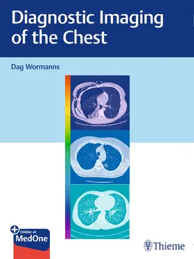 Wormanns |  Diagnostic Imaging of the Chest | Buch |  Sack Fachmedien