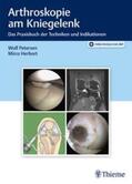 Petersen / Herbort |  Arthroskopie am Kniegelenk | Buch |  Sack Fachmedien