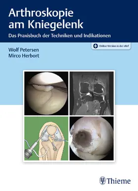 Petersen / Herbort |  Arthroskopie am Kniegelenk | eBook | Sack Fachmedien