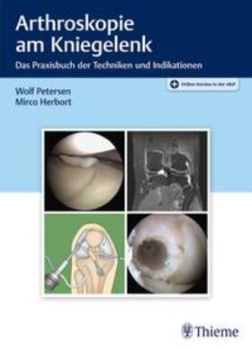 Petersen / Herbort | Arthroskopie am Kniegelenk | E-Book | sack.de