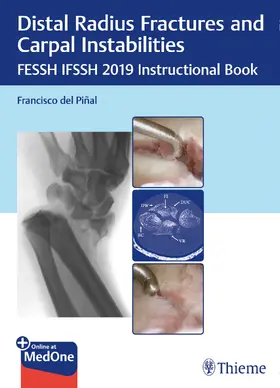 Pinal / Pin~al |  Distal Radius Fractures and Carpal Instabilities | Buch |  Sack Fachmedien