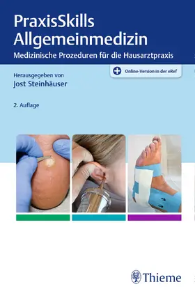 Steinhäuser | PraxisSkills Allgemeinmedizin | E-Book | sack.de