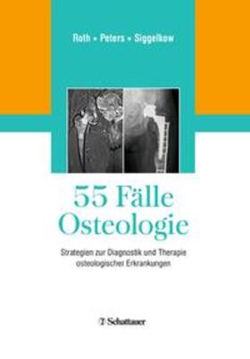 Roth / Peters / Siggelkow |  55 Fälle Osteologie | Buch |  Sack Fachmedien