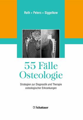 Roth / Peters / Siggelkow | 55 Fälle Osteologie | E-Book | sack.de