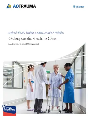Blauth / Kates / Nicholas | Osteoporotic Fracture Care | E-Book | sack.de