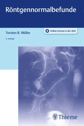 Möller |  Röntgennormalbefunde | Buch |  Sack Fachmedien