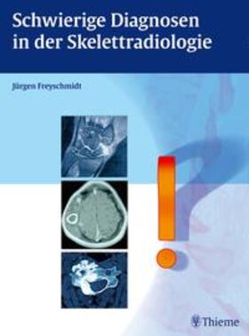Freyschmidt | Schwierige Diagnosen in der Skelettradiologie | Medienkombination | 978-3-13-243161-4 | sack.de