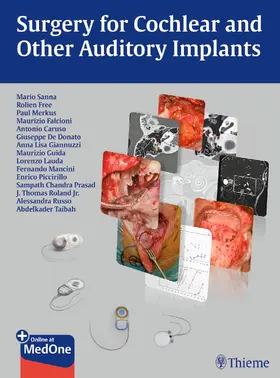 Sanna / Free / Merkus |  Surgery for Cochlear and Other Auditory Implants | Buch |  Sack Fachmedien