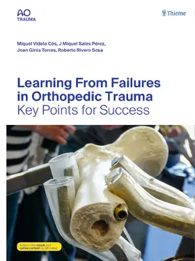 Videla Cés / Rivero Sosa / Sales Pérez | Learning From Failures in Orthopedic Trauma | Medienkombination | 978-3-13-243456-1 | sack.de
