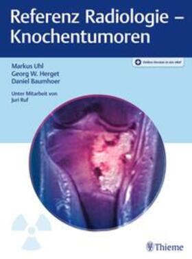 Uhl / Herget / Baumhoer | Referenz Radiologie - Knochentumoren | Medienkombination | 978-3-13-243930-6 | sack.de
